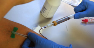 5 Reasons You Need Celiac Disease Testing